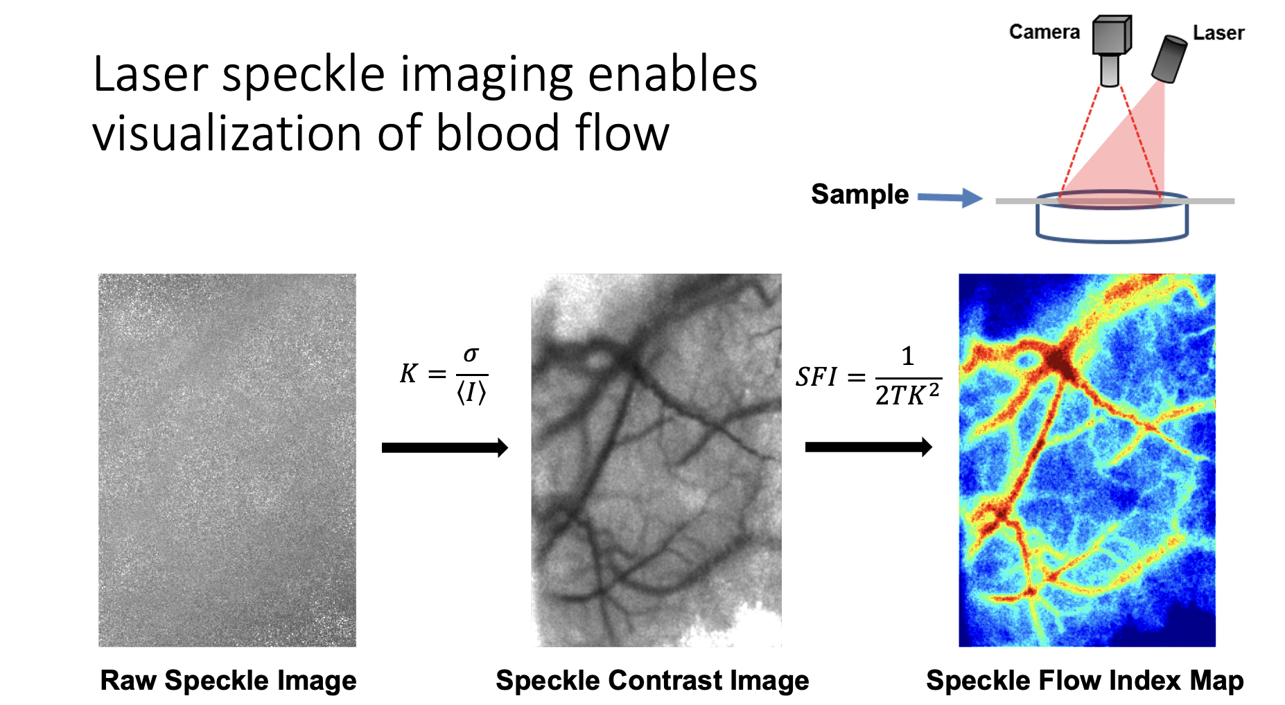 Laser Speckle Imaging Technology